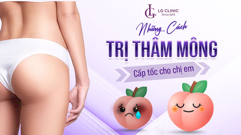 Cách trị thâm mông dứt điểm – Cho vòng 3 căng tròn, láng mịn