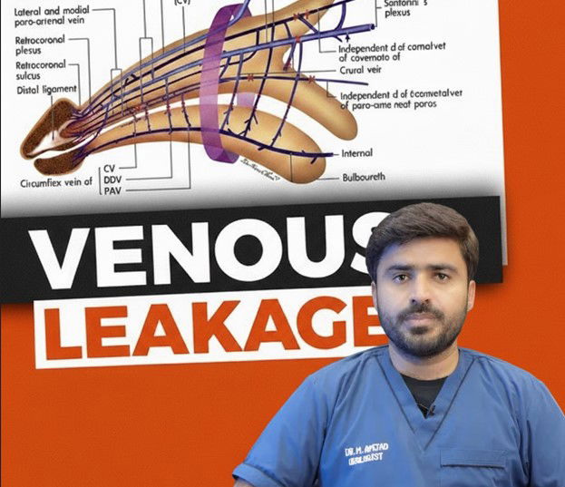Venous Leak; Best Treatment for Venogenic ED