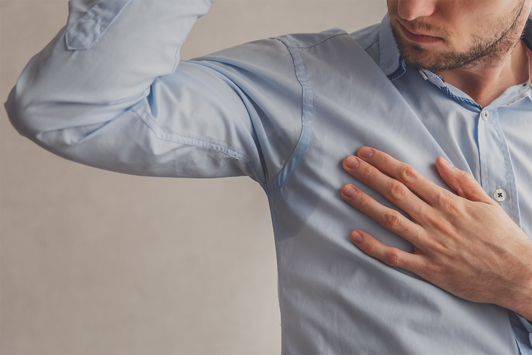Is Excessive Sweating Normal? Signs You May Have Hyperhidrosis