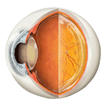 Cataract Treatment in Bangalore, India | Narayana Nethralaya