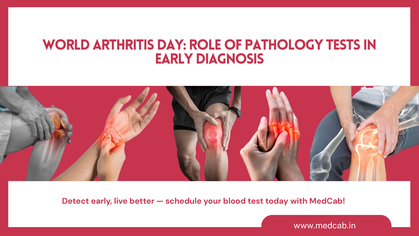 World Arthritis Day: Role of Pathology Tests in Early Diagnosis