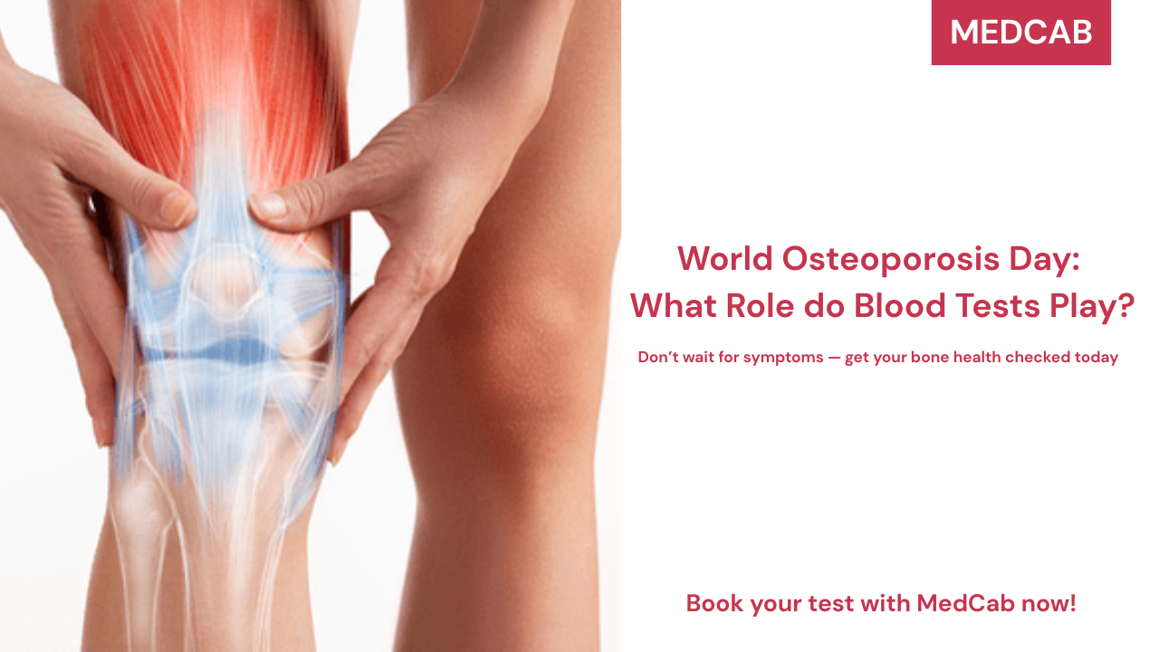 World Osteoporosis Day: What Role do Blood Tests Play?