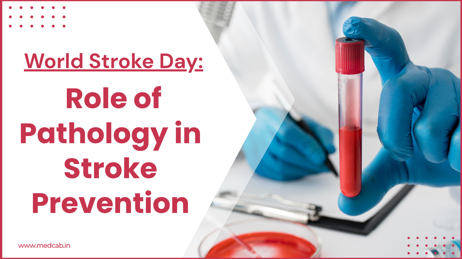 World Stroke Day: Role of Pathology in Stroke Prevention