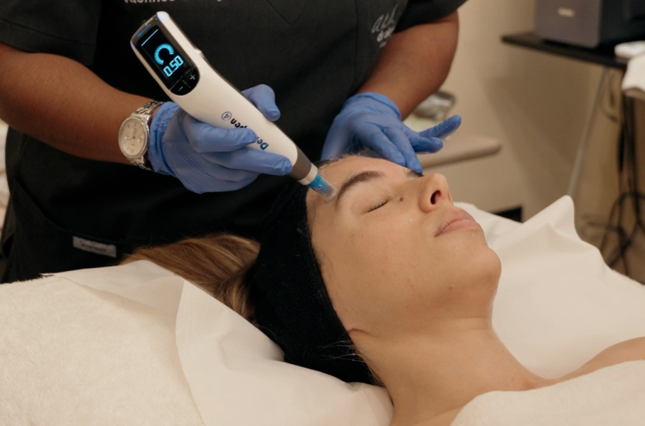 Micro Needling for Skin Rejuvenation and Smooth Texture