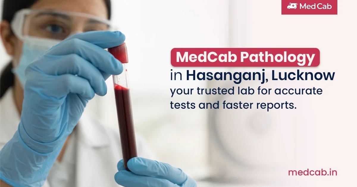 Blood Glucose Test in Hasanganj, Lucknow