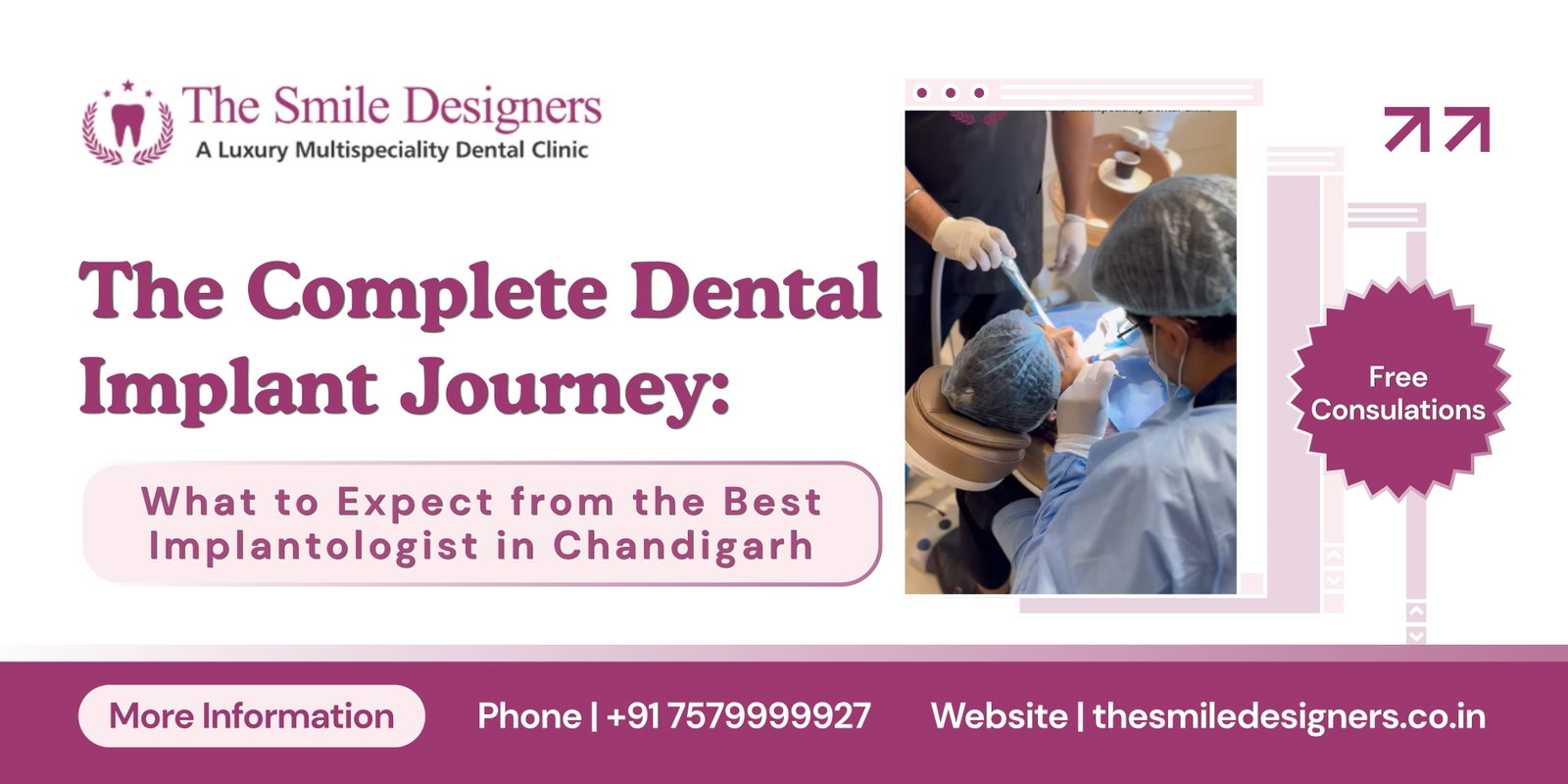 The Complete Dental Implant Journey: What to Expect from the Best Implantologist in Chandigarh