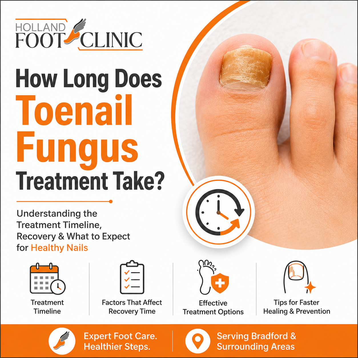 How Long Does Toenail Fungus Treatment Take?