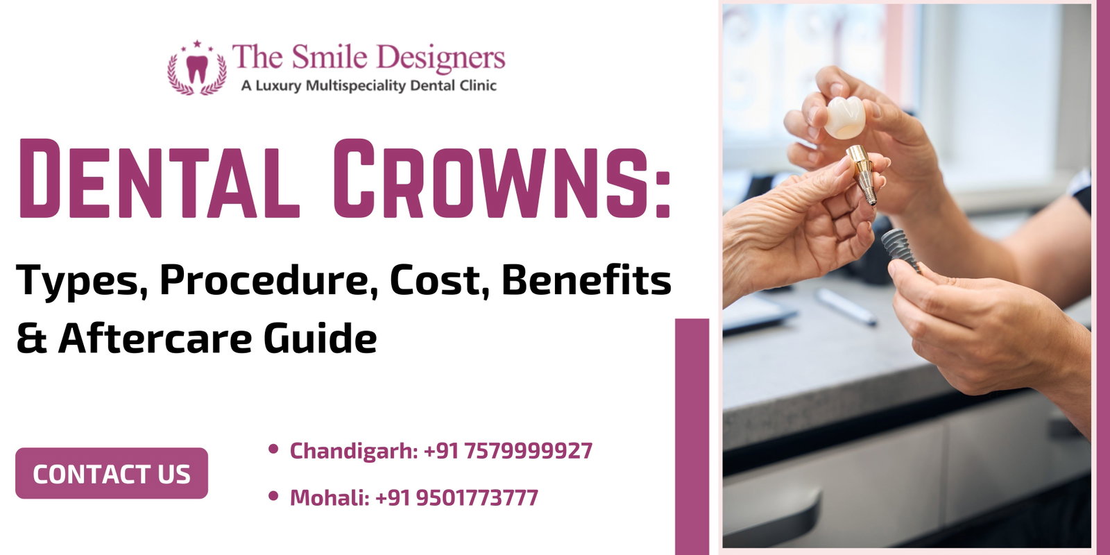 Dental Crowns: Types, Cost & Procedure Guide | Chandigarh, Mohali