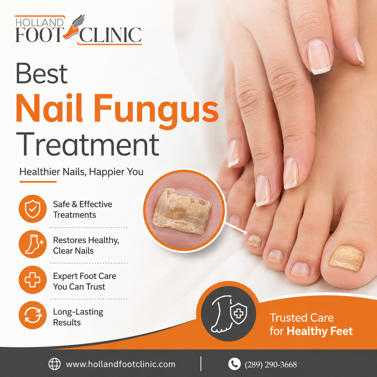 Best Nail Fungus Treatment | Expert Care for Healthy Toenails