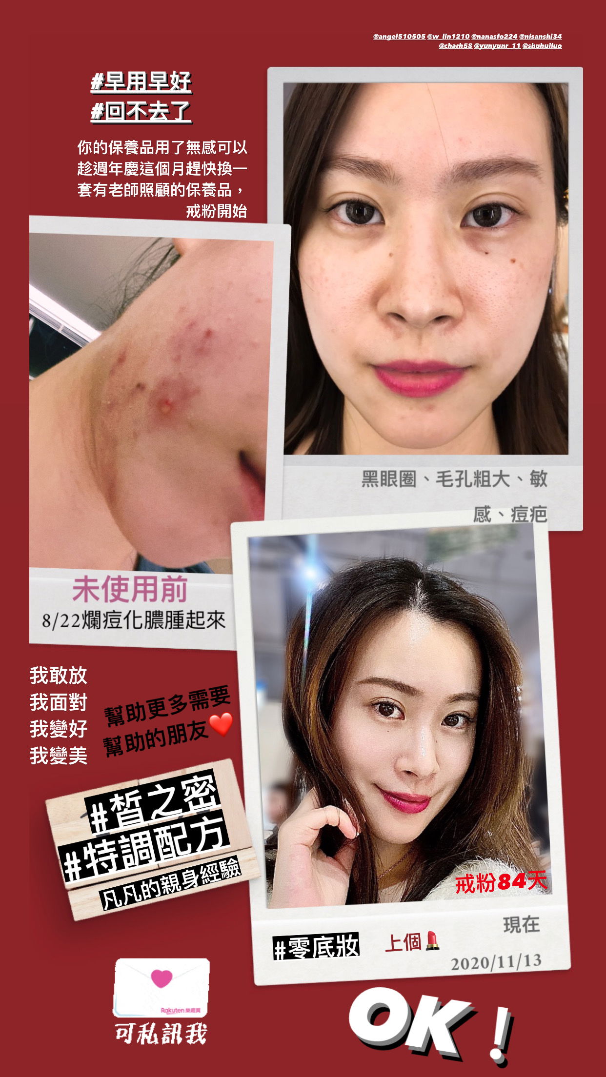 什麼痘都不存在了