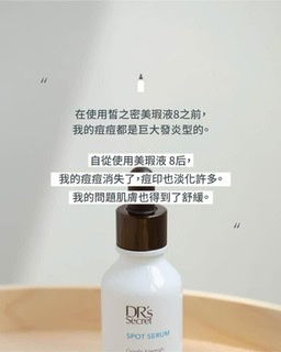 痘痘粉刺的剋星