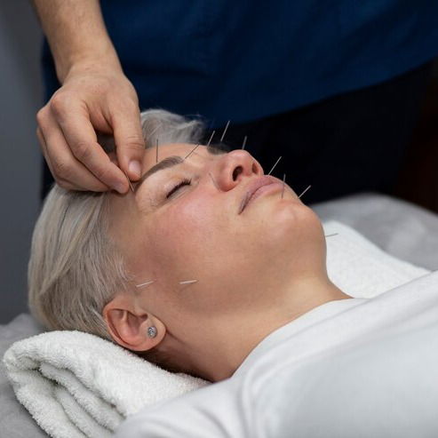 Ultimate Guide to Acupuncture in Orange County: What You Need to Know - PDF Free Download